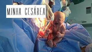 Parto Do Isaac