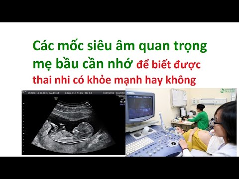 Các mốc siêu âm quan trọng mẹ bầu cần nhớ: thời điểm siêu âm quan trọng
