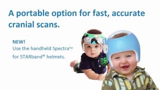 Spectra 3D scanning for cranial orthotic