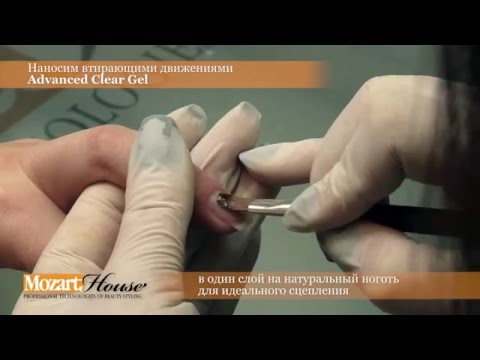 Ишемический инсульт: симптомы, последствия, прогноз Зубы к чему снятся во сне? Если видишь во сне