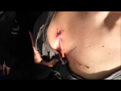 oberflächenpiercing (surface bar) dekollete teil zwei oberflächenpiercing (surface bar) dekollete teil zwei
