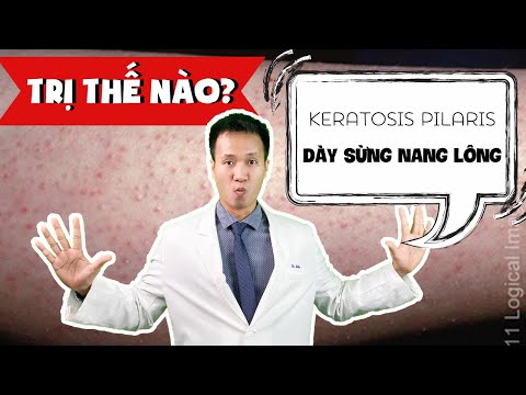 Dày sừng nang lông - Viêm nang lông là gì ? Cách xử trí chuẩn Y KHOA - Keratosis Pillaris | Dr Hiếu