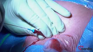 Installation Pacemaker