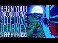 Love Yourself Unconditionally: Self Love Journey Sleep Hypnosis
