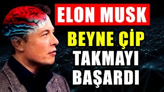 Elon Musk - Neuralink Türkçe