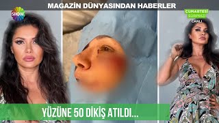 Eski Manken Tuğba Altıntopa Şilede Köpek Saldırdı