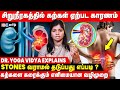 Kidney Stone Treatment Tamil | சிறுநீரக கல் கரைக்க எளிய வழிமுறைகள்..! - Dr. Yoga Vidya Vidya Advice
