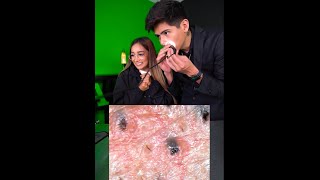 Así Se Ve La Cara De Antrax Con Un Microscopio