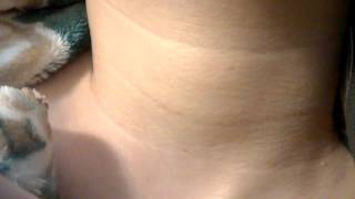 Visible Female Neck Pulse No Sound