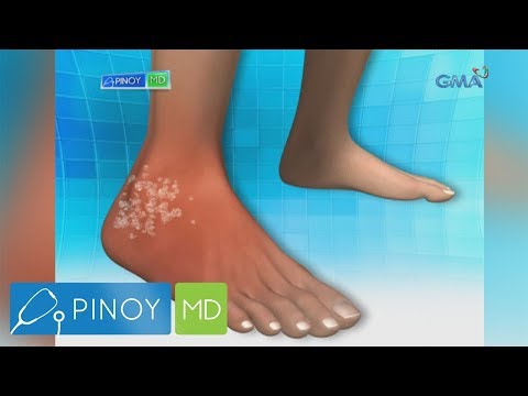 Pinoy MD: Posible bang magkagout sa edad na 22?