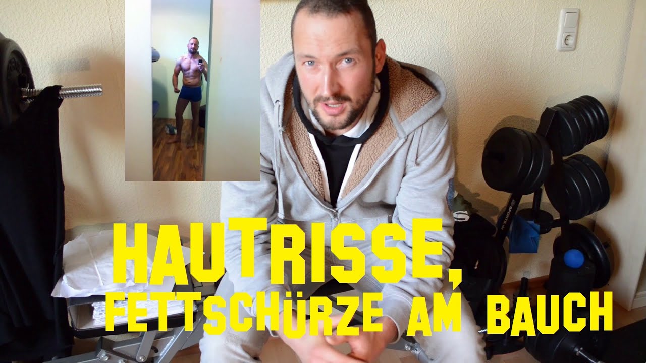 Man muss die Nägel die Onychomykosen behandeln
