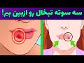 تبخال چگونه درمان میشود|سریع ترین راه درمان تبخال|درمان فوری تبخال درخانه