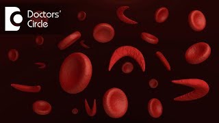 What Is Management Of Anisocytosis Hypochromic Anemia?-Dr. Surekha Tiwari