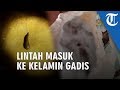 Lintah Masuk ke dalam Alat Kelamin Gadis Berusia 4 Tahun, Diduga Ini Penyebabnya