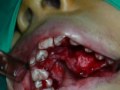 cirugía dental