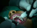 cirugía dental