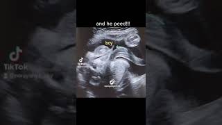 Baby Boy Peed In Womb