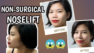 SHINAGAWA Aesthetics NON-SURGICAL NOSELIFT (In An INSTANT!!!)