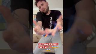 Kolonya İle Eli̇ni̇ Yakma Şakasi Sonu Felaket