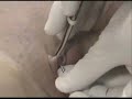 genital tattoo