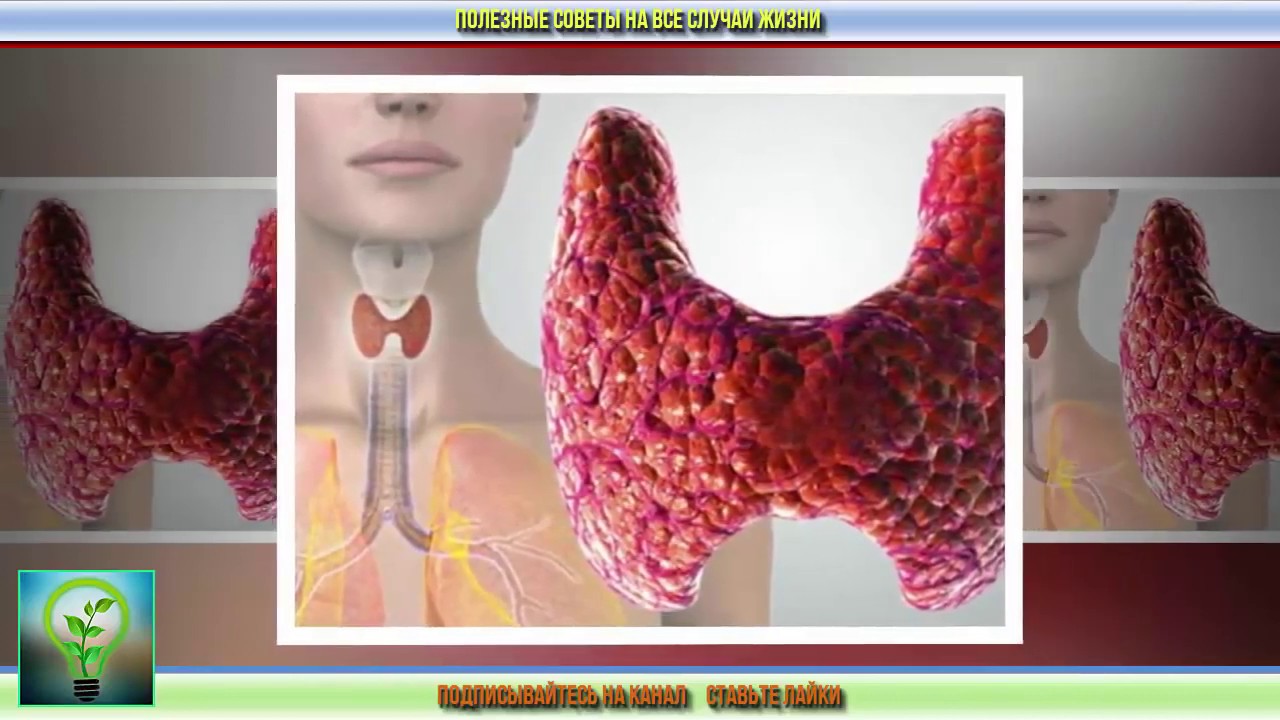Щитовидная Железа Правильное Питание
