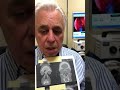 In Office Balloon Sinus Dilation 10 minutes ago and very comfortable