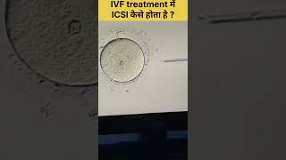 Icsi Procedure In Ivf, Intracytoplasmic Sperm Injection