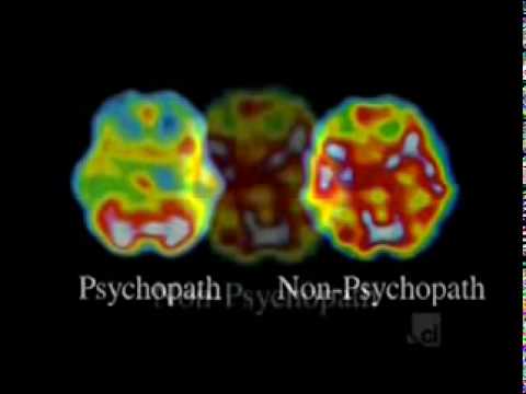 Is Psychopathy Curable Psychologyofpsychopaths