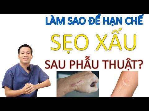 Làm sao để hạn chế SẸO LỒI, SẸO LÕM sau phẫu thuật ?
