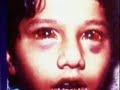 abuse awareness & prevention *WARNING GRAPHIC IMAGES* Parental Discretion advised #1