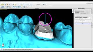 Conventional Crown Design in BlueSkyPlan 4.8.2