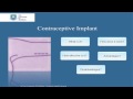 The Implant (Contraceptive)