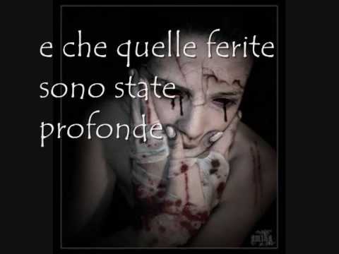 Osteochondrosis e tosse di vsd
