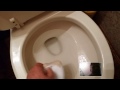 How to Get Rid of Athlete's Foot - @OpieRadio