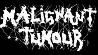 Watch Malignant Tumour In Bottle Theres No Law video