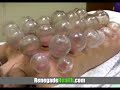 Top 10 Strange Alternative Medicine Practices #115