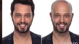 Ünlülerin Kel Halleri