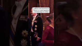 Letizia Da La Nota Sentada En Un Taburete En Holanda.se Inventa El Neuroma De Morton.