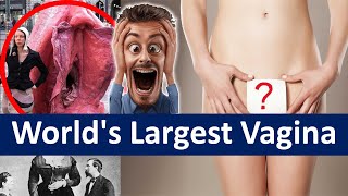 World's Largest Vagina | Biggest Vagina