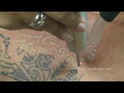 tattooed eyebrows gone wrong. quality tattoo ink cosmetic tattooing training