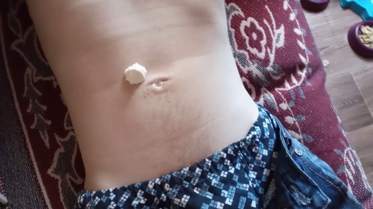Bbw belly button torture