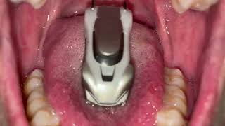 Swallowing Micro Machines Vore