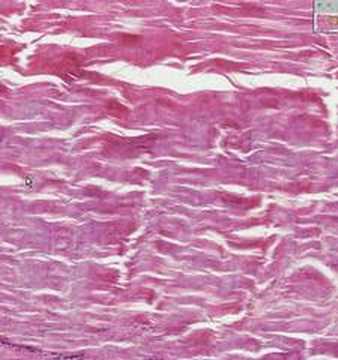 Shotgun Histology Dense Regular Connective Tissue - YouTube