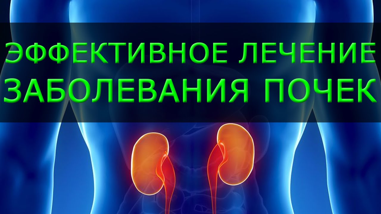 Лечить воспаление почек в домашних условиях Лечить воспаление почек в домашних условиях