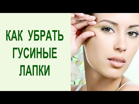Как избавится морщин гусиные лапки Как избавится морщин гусиные лапки