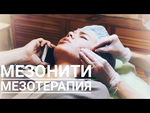 Мезонити и мезотерапия волосистой части головы. Встреча с Оксаной после 3-х летнего перерыва Мезонити и мезотерапия волосистой части головы. Встреча с Оксаной после 3-х летнего перерыва