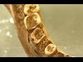 Scientists identify first case tooth