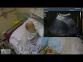 hepatic biopsy