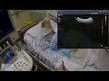 hepatic biopsy