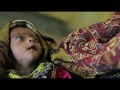 Six months after floods struck, malnutrition hits hard in affected areas of Pakistan